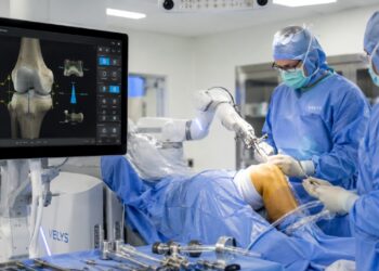 Robô planeja cirurgia nos mínimos detalhes e guia a mão do cirurgião: clínica atinge 50 próteses de joelho e quadril com precisão quase total