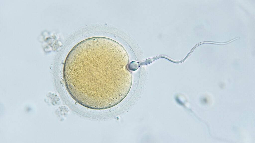 O HyperSperm, uma tecnologia inovadora desenvolvida por cientistas argentinos, ganhou destaque na medicina reprodutiva, pois além de aprimorar a fertilização, eleva consideravelmente as possibilidades de gestação