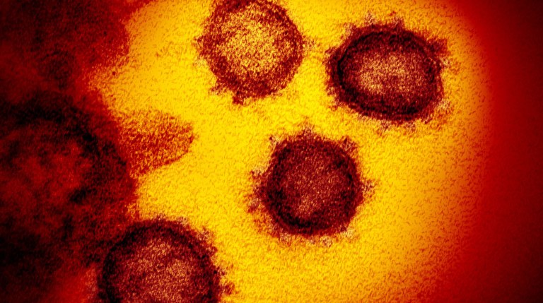 Imagem do microscópio eletrônico de transmissão mostra o SARS-CoV-2 – também conhecido como 2019-nCoV, o vírus que causa o COVID-19