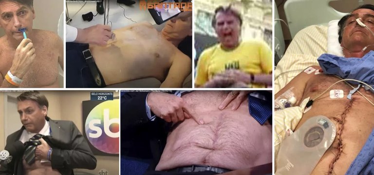 O exame revela que, estranhamento, a cicatriz mudou de lugar