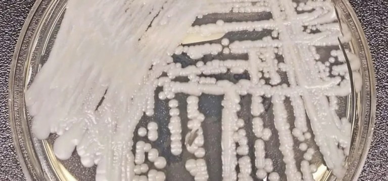 Fungo Candida auris