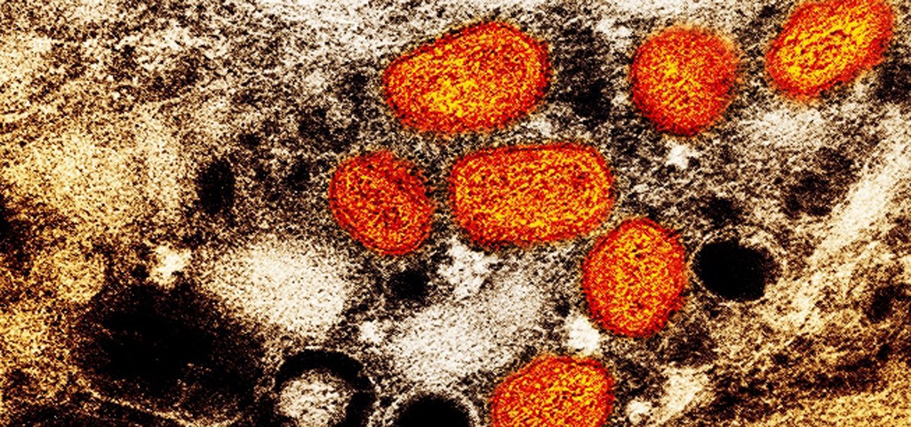 Micrografia eletrônica de transmissão colorida de partículas de varíola de macaco encontradas dentro de uma célula infectada.