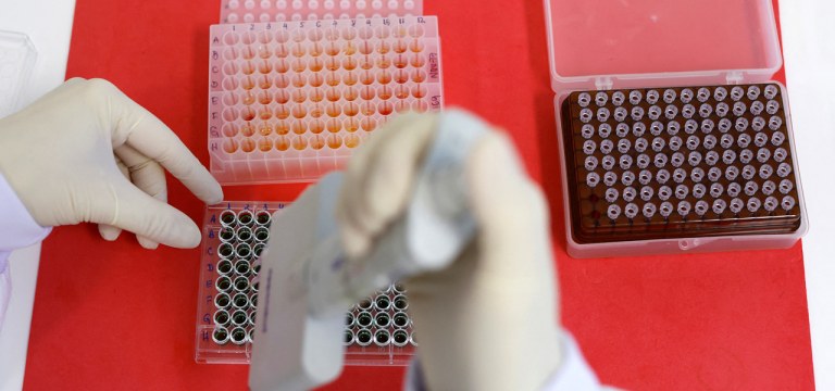 Funcionário trabalha em teste para detecção de anticorpos do vírus da gripe aviária no Laboratório de Referência da Organização Mundial de Saúde Animal em Campinas, 25/04/2023