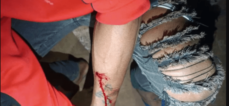 Indígena ferido após ataque no Paraná
