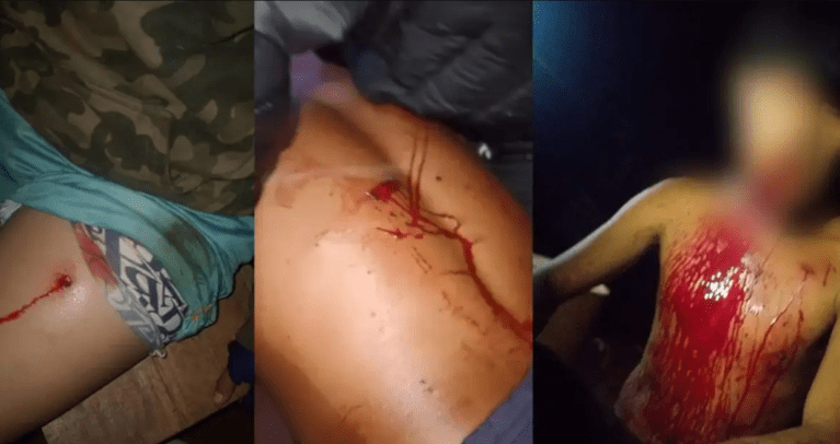 Na noite de sexta-feira (3), quatro indígenas da comunidade Yvy Okaju (antigo Y’Hovy), do povo Avá-Guarani, foram feridos a tiros