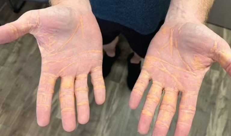 A mão do homem com o "vazamento"