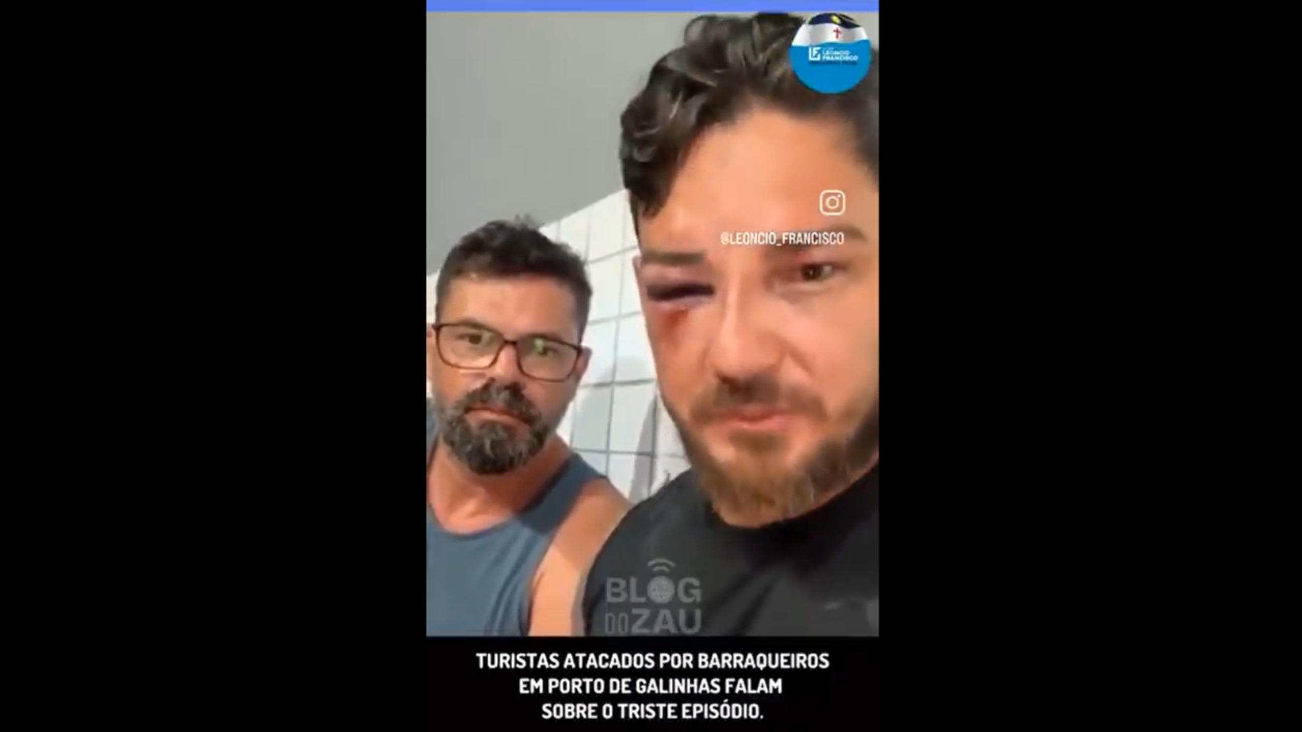 Casal agredido na praia de Porto de Galinhas (PE)
