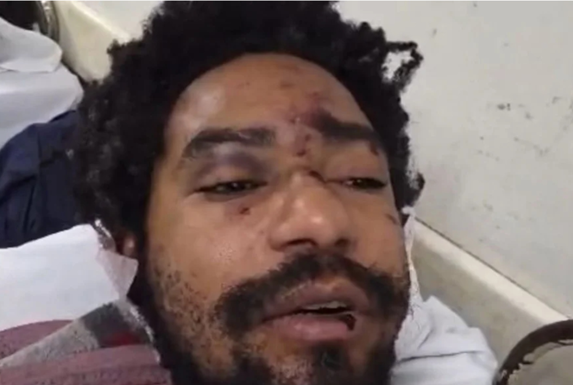Diego Souza Moreira, ator e drag queen, teria sofrido hemorragia interna por causa das agressões